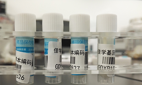 【佳学基因检测】做Bosch-Boonstra-Schaaf视神经萎缩综合征基因解码、基因检测需要多长时间？