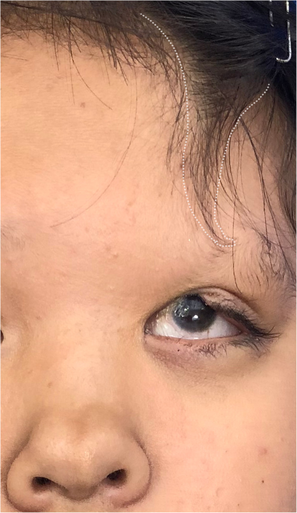 【佳学基因检测】鼻尖裂成两半基因解码、基因检测怎么预约解读？