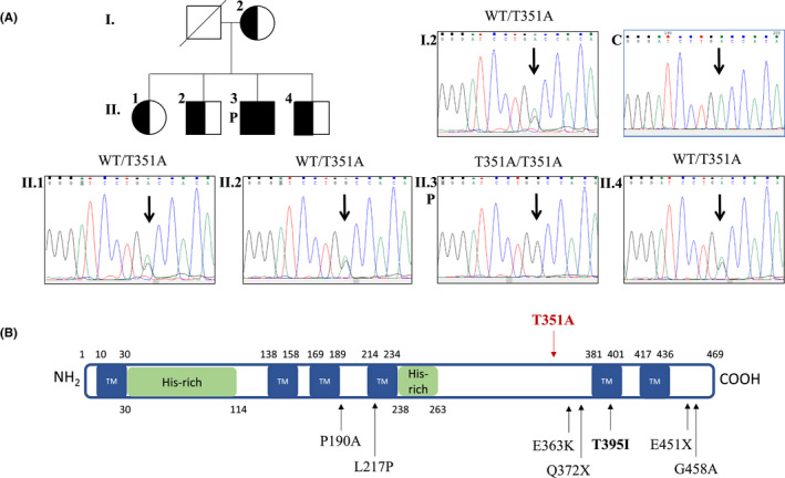 【佳学基因检测】无丙型球蛋白血症非布鲁顿型基因筛查怎么做才会准确? 【佳学基因检测】无丙型球蛋白血症非布鲁顿型基因筛查怎么做才会准确?
