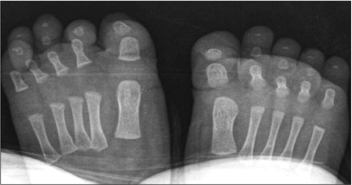 【佳学基因检测】心血管内科突变检测考查中关于CPS1的要点