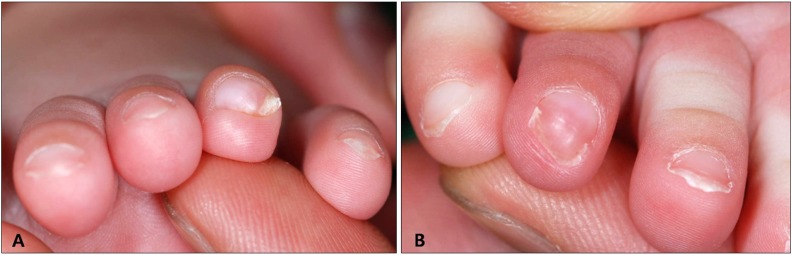 【佳学基因检测】遗传代谢科突变检测知识测验中关于CRHR2的准备