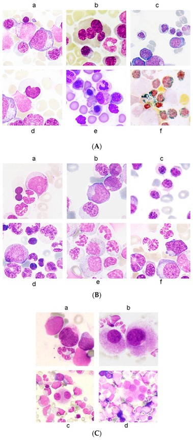 【佳学基因检测】染色体分子病理检测COL6A2存在突变，如何理解？
