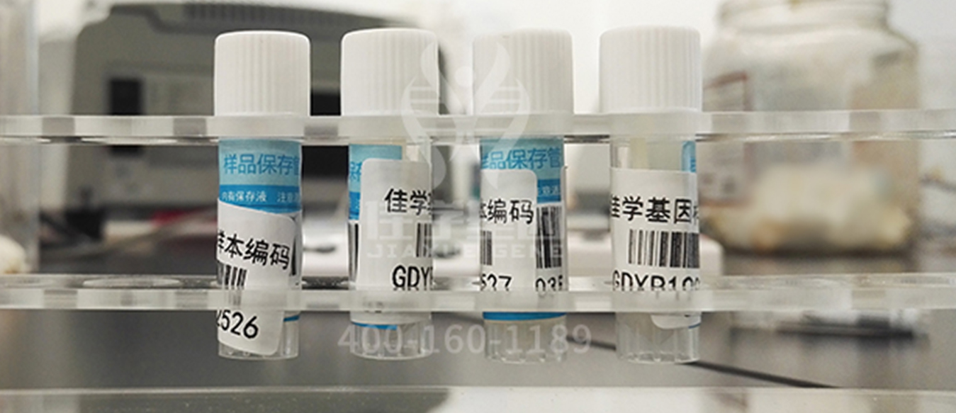 【佳学基因检测】肚子里的胎儿有三个月了，基因检测DAG1突变，该怎么办？