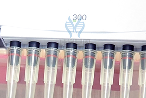 【佳学基因检测】遗传代谢科基因评估分析知识测验中关于FPR2的准备