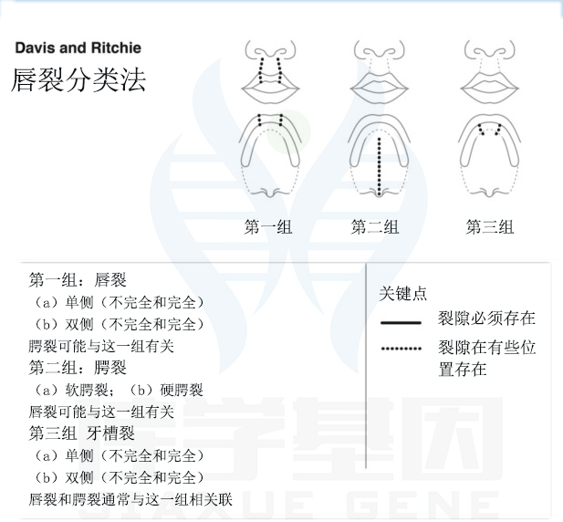 【佳学基因检测】唇裂不同分类命名系统的比较与统一 【佳学基因检测】唇裂不同分类命名系统的比较与统一