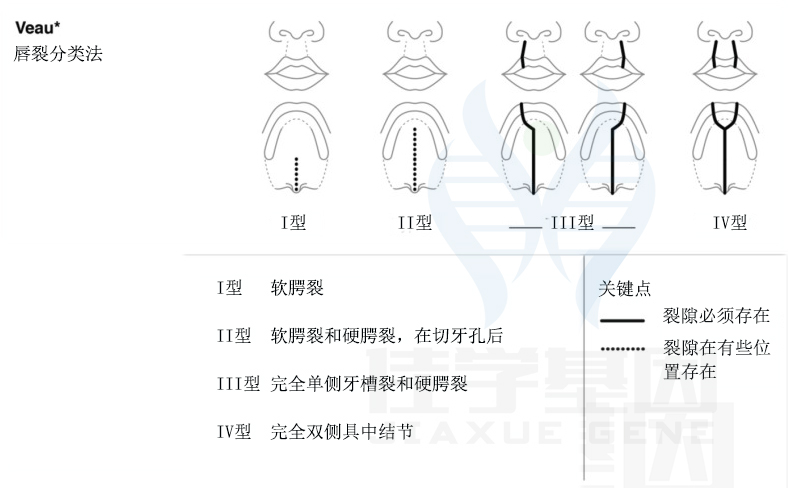 【佳学基因检测】唇裂不同分类命名系统的比较与统一 【佳学基因检测】唇裂不同分类命名系统的比较与统一
