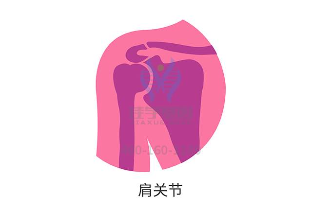 【佳学基因检测】骨关节炎基于基因检测的分子诊断分型 【佳学基因检测】骨关节炎基于基因检测的分子诊断分型