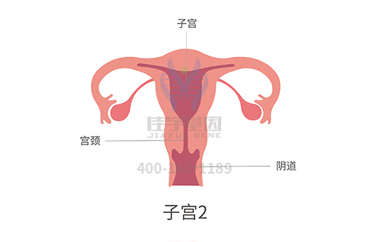 【佳学基因检测】卵巢癌基因解码、基因检测