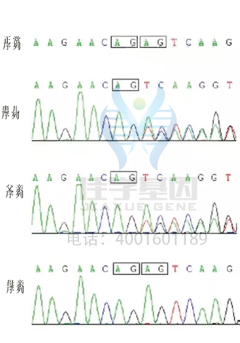 【佳学基因检测】DYT7突变检测后采用什么药物治疗比较有效果？
